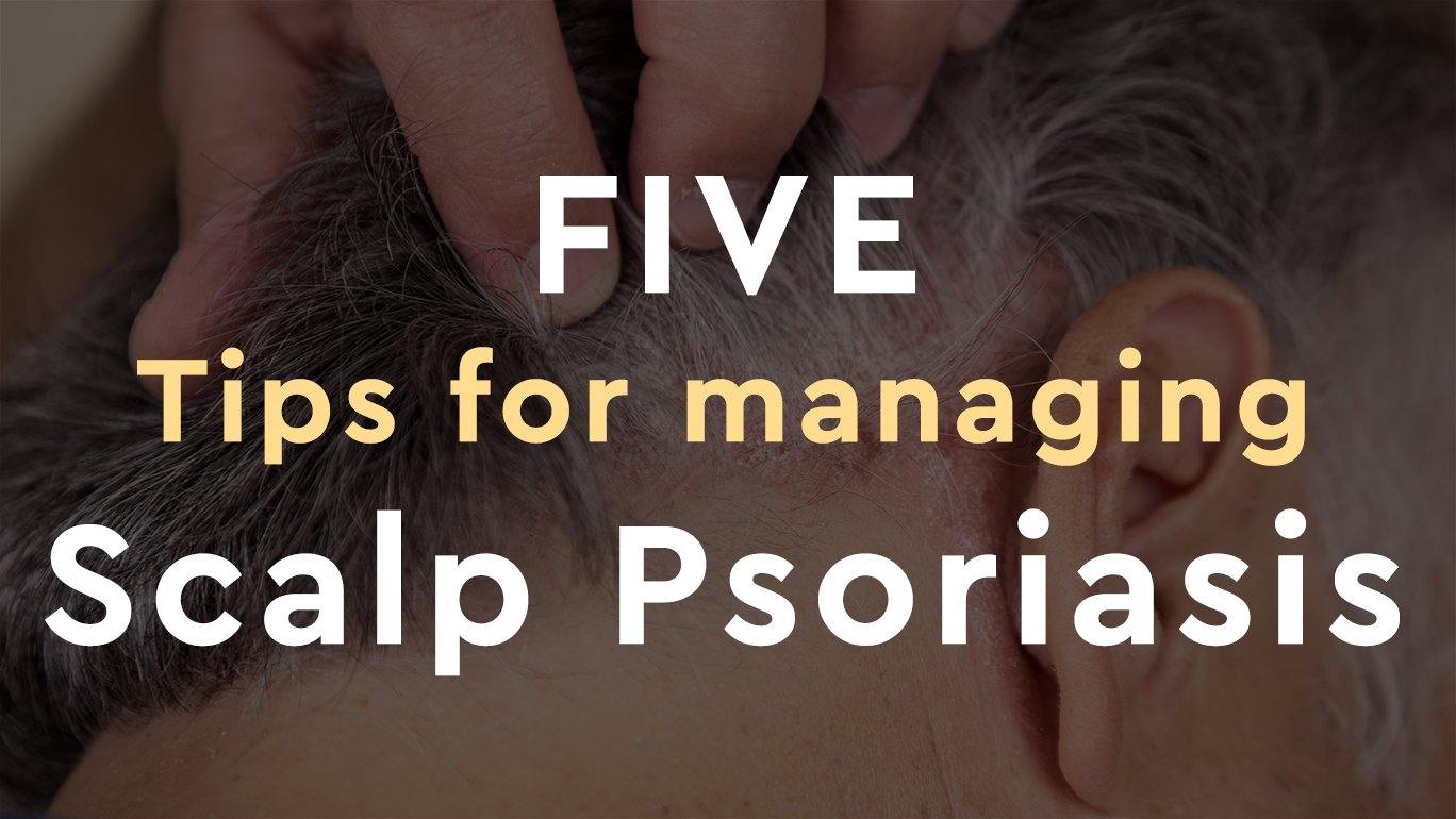 5 Tips for Managing Scalp Psoriasis - Psoriasis Honey
