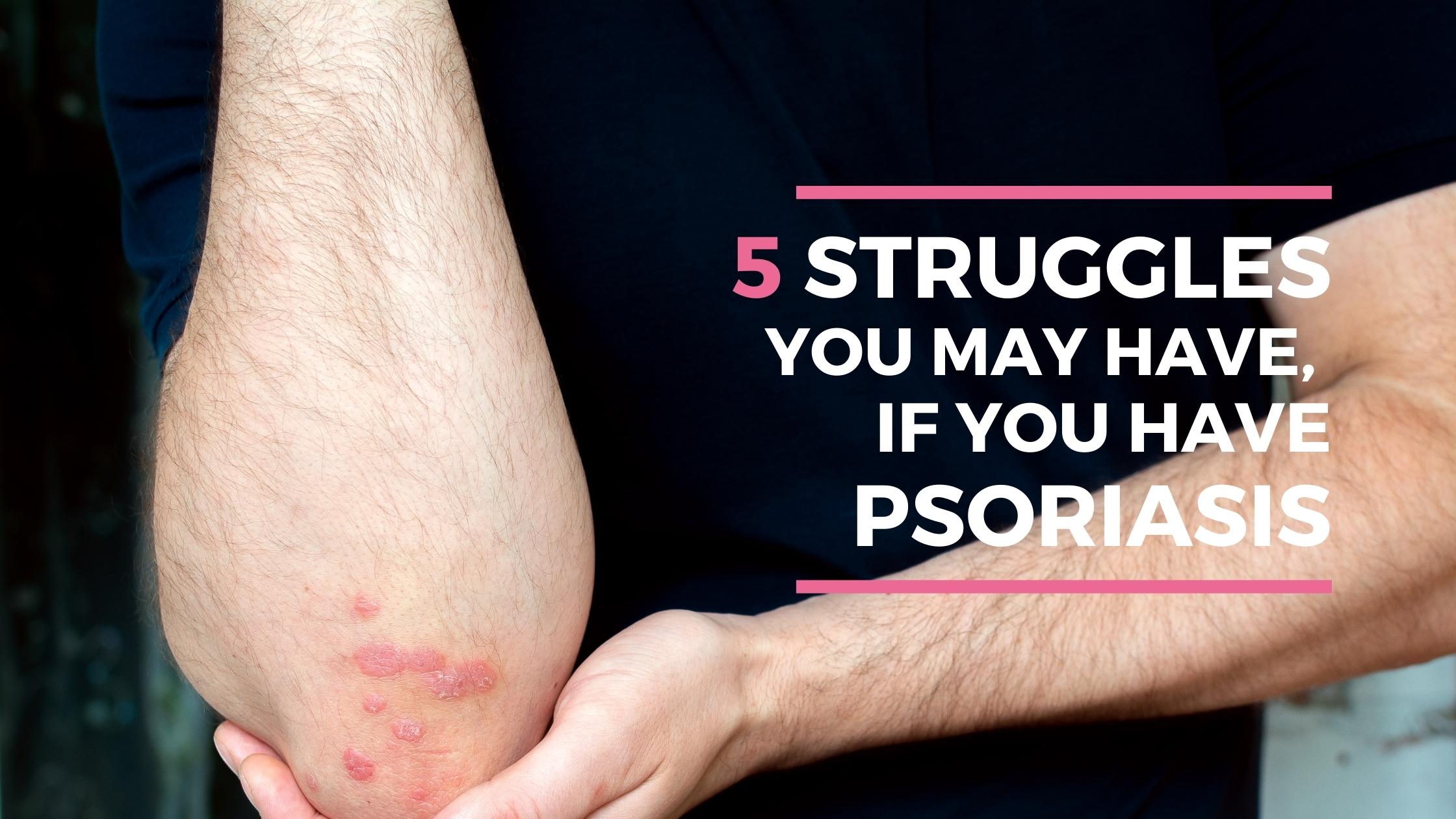 struggles of psoriasis