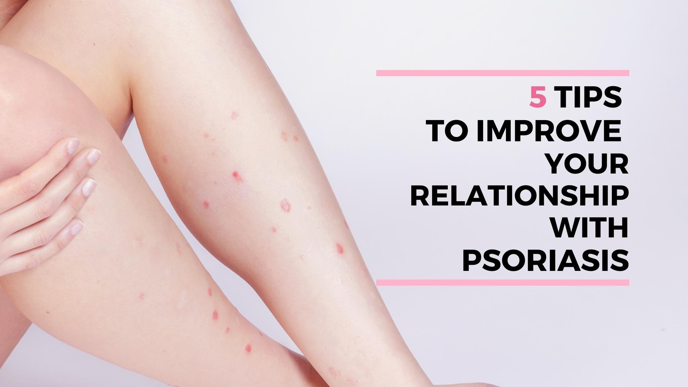 tips to improve psoriasis