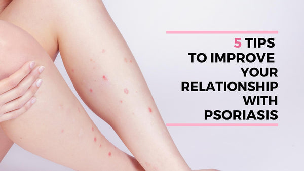 tips to improve psoriasis