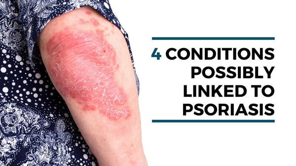 4 Conditions Possibly Linked to Psoriasis