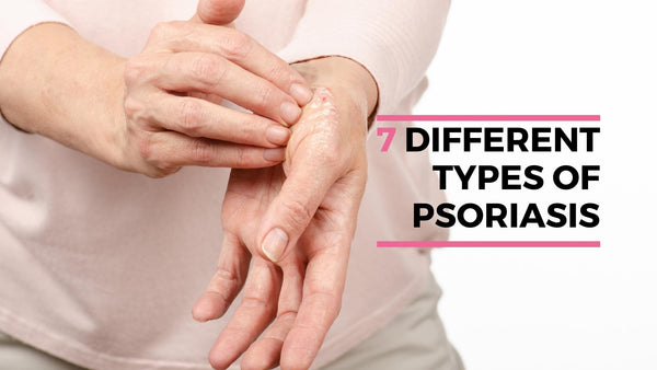 7 types of psoriasis