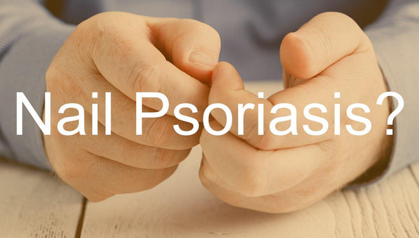 5 Tips On Managing Nail Psoriasis - Psoriasis Honey